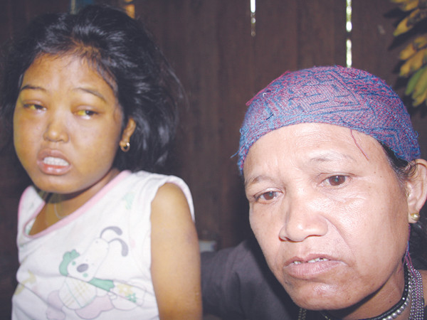 Phạm Thị Ân đang tuyệt vọng vì bệnh tật