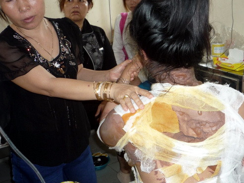 Chưa ngăn chặn người chồng tạt nước sôi vợ