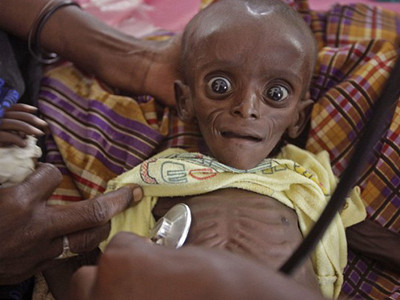 Nạn đói hoành hành ở Somalia
