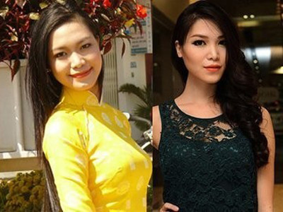 Tiết lộ giá nâng mũi, gọt cằm của giới nghệ sĩ