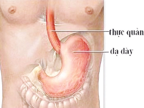 Bệnh dạ dày tấn công người thành thị