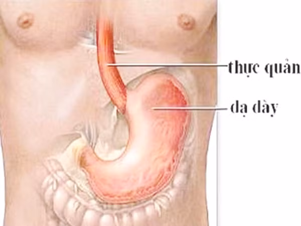 Bệnh dạ dày tấn công người thành thị
