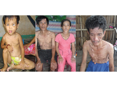 Những người khổ vì “bệnh lạ”