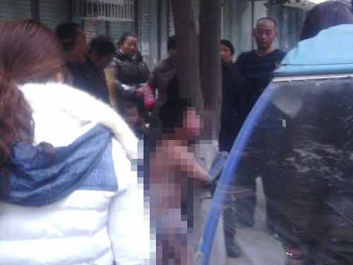 Sốc: Bé 9 tuổi bị bố lột quần áo, đánh đập giữa trời lạnh 5 độ C