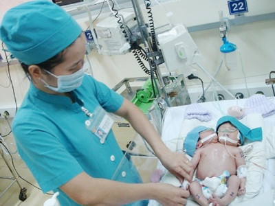 Xác suất thành công tách bé gái hai đầu rất thấp