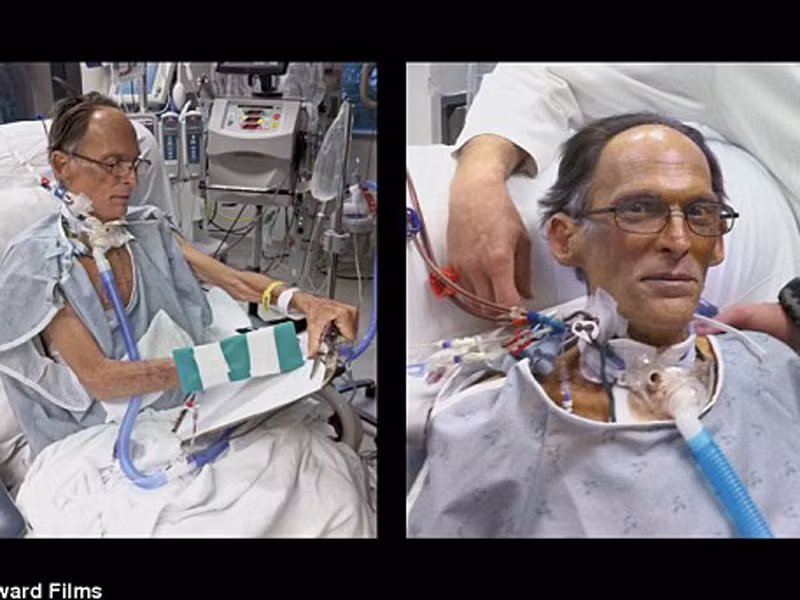 Người không tim vẫn sống