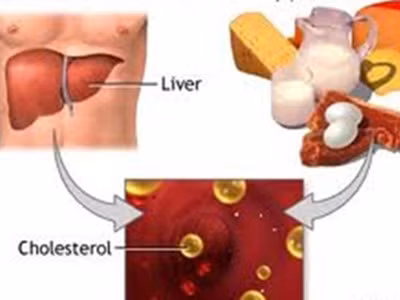 Làm gì để phòng ngừa tăng cholesterol máu?