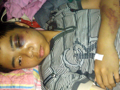 Công an bị đình chỉ vì hành hung học sinh