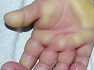 Kết luận bước đầu về 'bệnh lạ' ở Quảng Ngãi