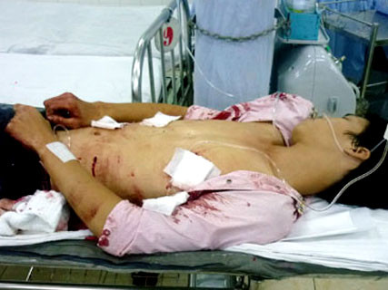 Nghi án chồng đâm chết vợ rồi tự sát