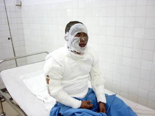 Tạt nguyên xô a xít vào chồng tại bến xe buýt