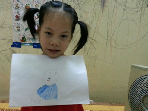 Bé gái ‘không chân tay’ giống Nick