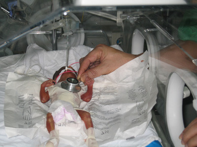 Hồi sinh trẻ 'bút bi'