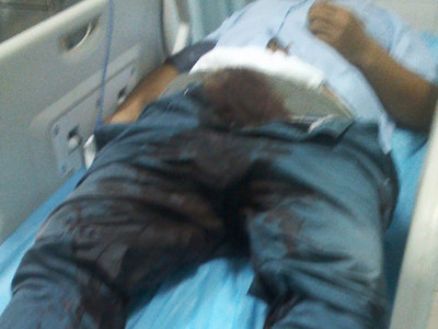 Cắt phăng 'của quý' vì không có bạn gái