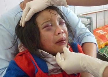 Bắt khẩn cấp đối tượng đánh đập con nuôi