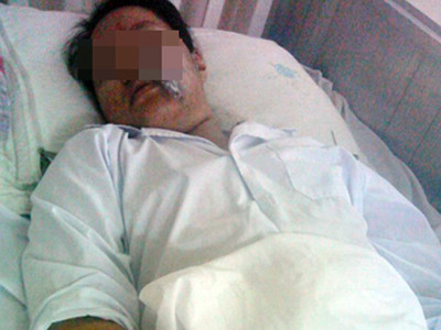 Khóa trái cửa, phóng hoả nhà vợ cũ