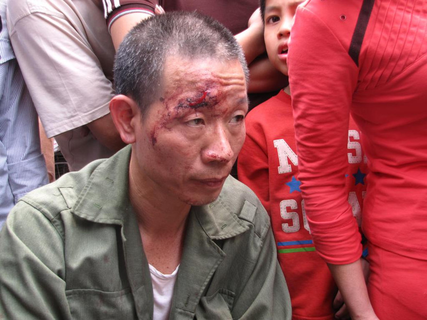 Bộ Công an chỉ đạo làm rõ 'dân tố công an đánh người'