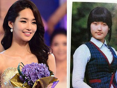 9 kiều nữ Hàn thừa nhận phẫu thuật thẩm mỹ