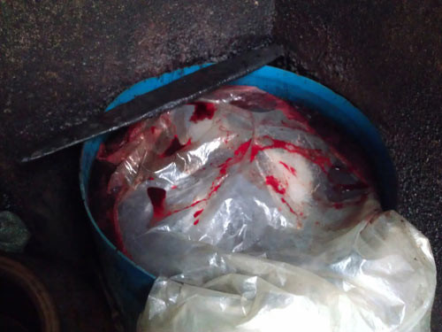 Ăn tiết canh vịt 'giả', mắc bệnh liên cầu khuẩn heo