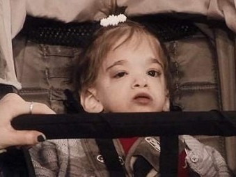 Thiếu nữ 20 tuổi 'kẹt' trong hình hài đứa trẻ sơ sinh