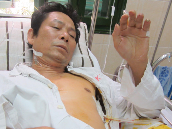 Ông Khải đang điều trị tại BV Việt Đức