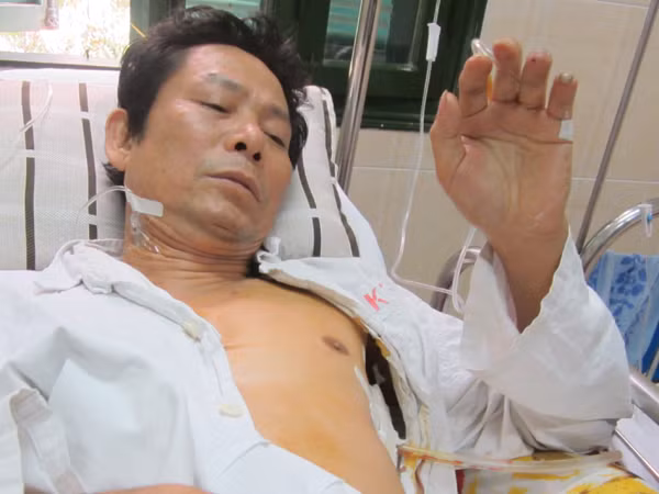 Ông Khải đang điều trị tại BV Việt Đức