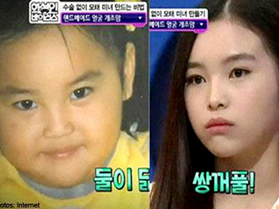 Mẹ Hàn Quốc 'nắn' mặt cho con bằng mát-xa và thìa