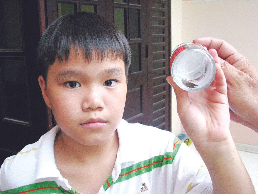 Cháu Nam Khánh, con trai chị Cẩm Thanh với lọ đựng những con bọ xít cắn người. Ảnh: Tr.Q