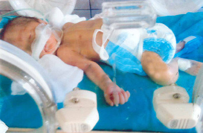 Một thanh niên gặp khó khăn cần trợ giúp