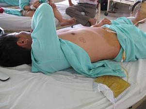 Vợ bạo hành chồng: Đòn độc của “phái yếu”