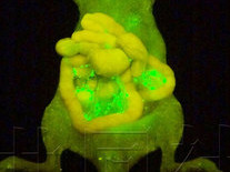 Thuốc xịt xác định tế bào ung thư