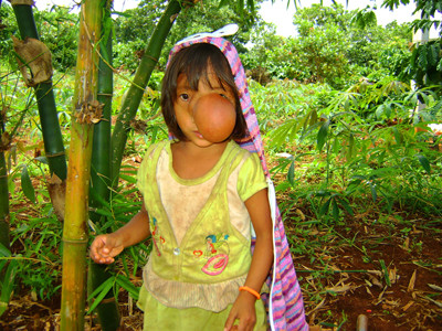 Em muốn đi khám bệnh