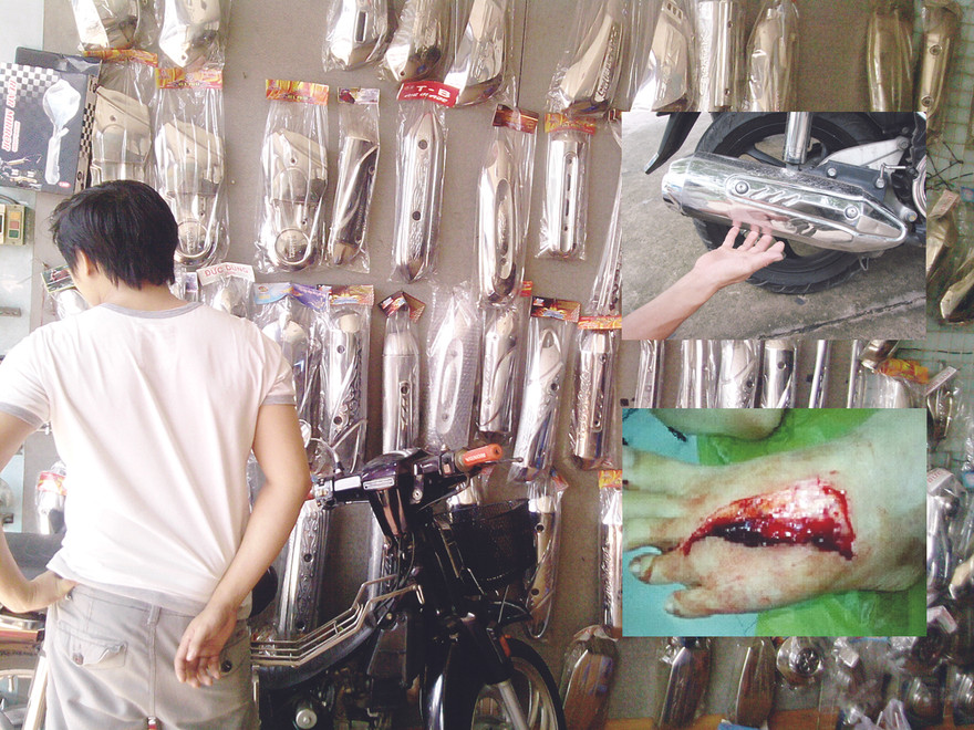 Ốp bô xe máy bán tràn lan trên đường Trần Quang Khải, quận 1, TPHCM (ảnh lớn). Ốp bô Inox cứa toạc chân một em bé 7 tuổi tại TPHCM (ảnh nhỏ) Ảnh: Lê Nguyễn