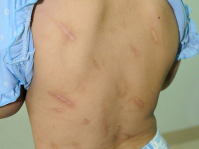 Bố dùng búa đinh đánh con gái 10 tuổi?