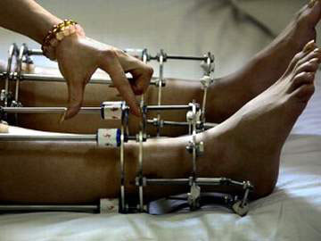 Nam giới rủ nhau đi kéo dài chân