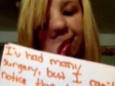 'Cô gái biến dạng' cầu xin đừng chế giễu mình