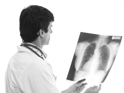 Phương pháp điều trị mới ung thư phổi giai đoạn muộn