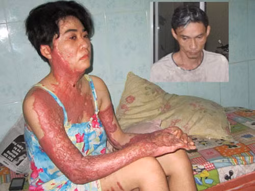 Chồng tạt xăng thiêu sống vợ