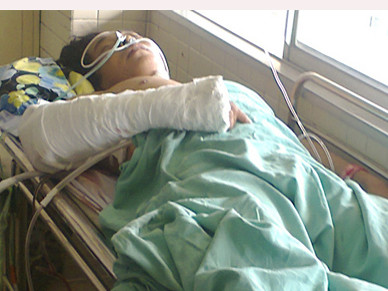 Bị bắn hơn 80 viên đạn chì vẫn sống