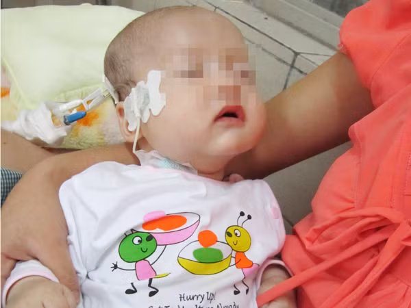 Số ca ngộ độc thuốc cam tăng mạnh