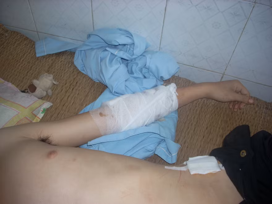 Bịt mặt chém người giữa đường