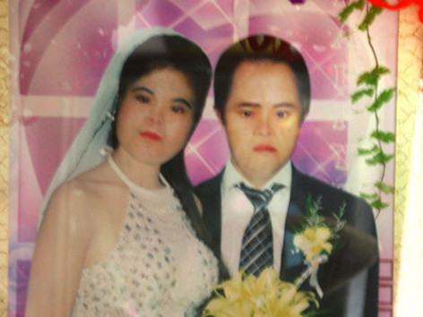 Chuyện tình vợ chồng bị thiểu năng trí tuệ