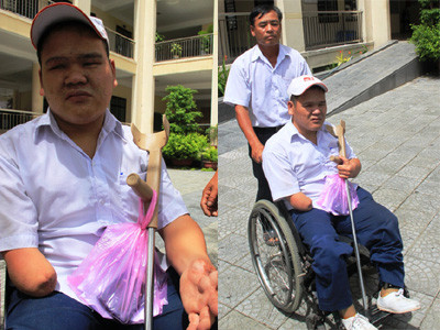 Nghị lực của thí sinh hỏng mắt, không chân, một tay