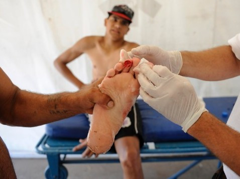 Cá Piranha cắn thịt 70 người