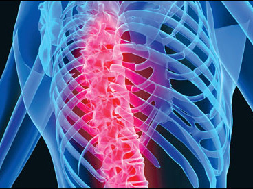 Những thói quen xấu gây bệnh loãng xương