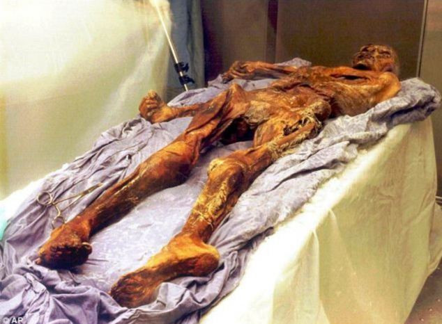 Nguyên nhân mới về cái chết của người băng Otzi