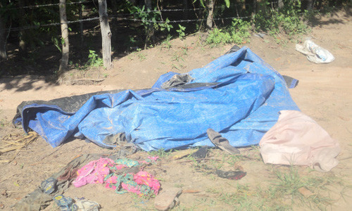 Sét đánh 18 người, 9 cháy sém, nhập viện