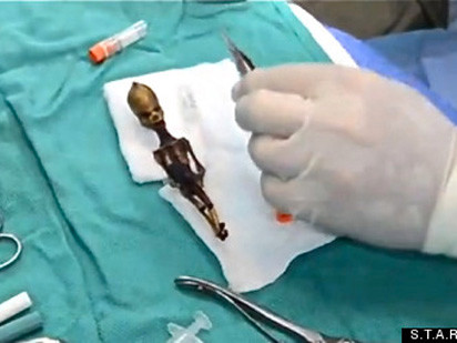 Khám 'sinh vật ngoài hành tinh' giống người