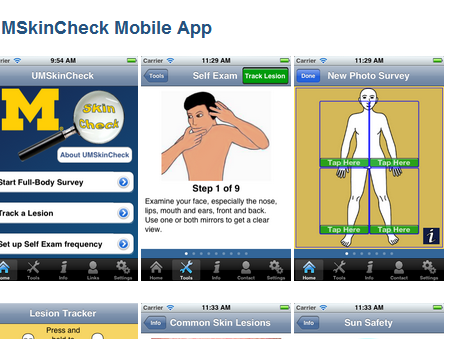 IPhone, iPad phát hiện ung thư da