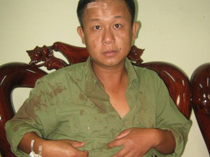 Kiểm lâm nhập viện vì... bị nhiều phụ nữ cắn